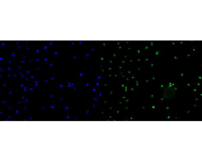 CENPB Antibody in Immunocytochemistry (ICC/IF)