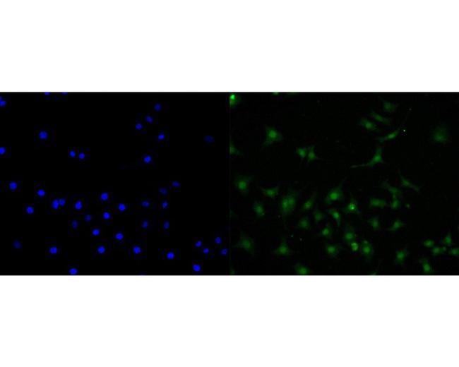 CENPB Antibody in Immunocytochemistry (ICC/IF)