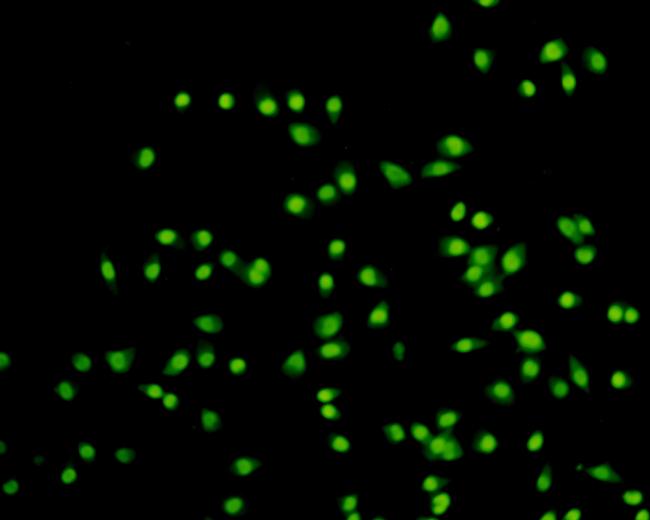 H3K9me3 Antibody in Immunocytochemistry (ICC/IF)