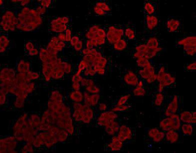 Catalase Antibody in Immunocytochemistry (ICC/IF)