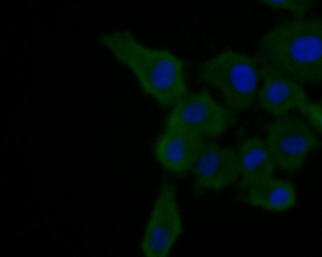 A2M Antibody in Immunocytochemistry (ICC/IF)