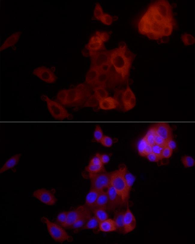 ALDH1A1 Antibody in Immunocytochemistry (ICC/IF)