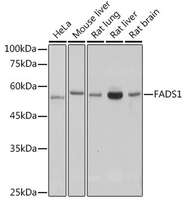 FADS1 Antibody in Western Blot (WB)