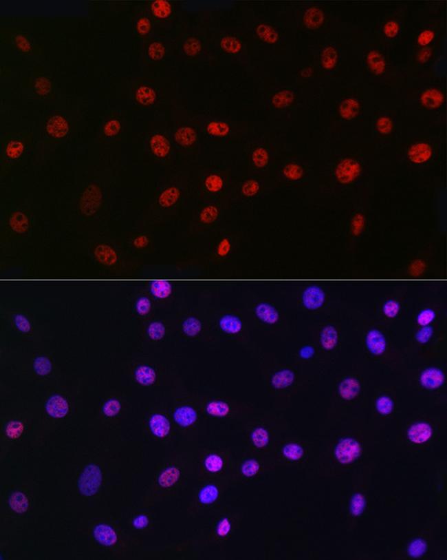 QKI Antibody in Immunocytochemistry (ICC/IF)