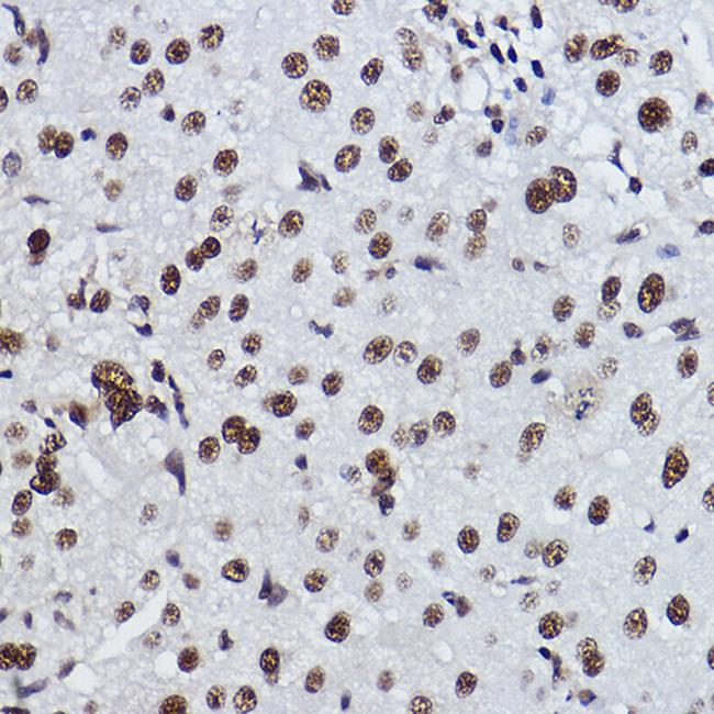 EXOSC7 Antibody in Immunohistochemistry (Paraffin) (IHC (P))