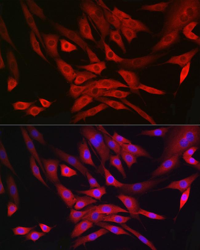 MRPL28 Antibody in Immunocytochemistry (ICC/IF)