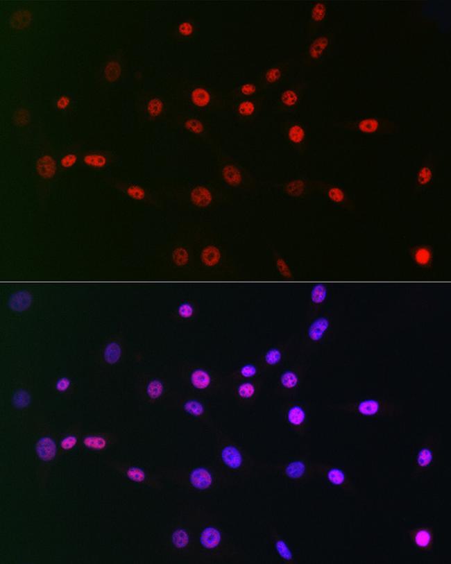 CtBP2 Antibody in Immunocytochemistry (ICC/IF)