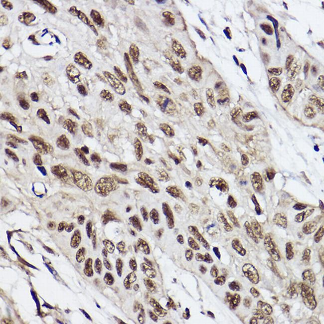 UBE2B Antibody in Immunohistochemistry (Paraffin) (IHC (P))