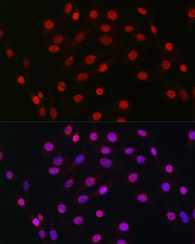 HDGF Antibody in Immunocytochemistry (ICC/IF)