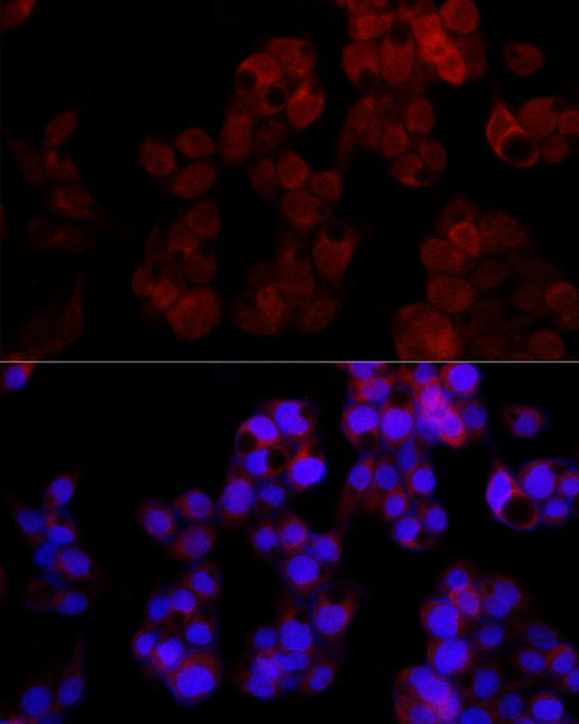 NUDT5 Antibody in Immunocytochemistry (ICC/IF)