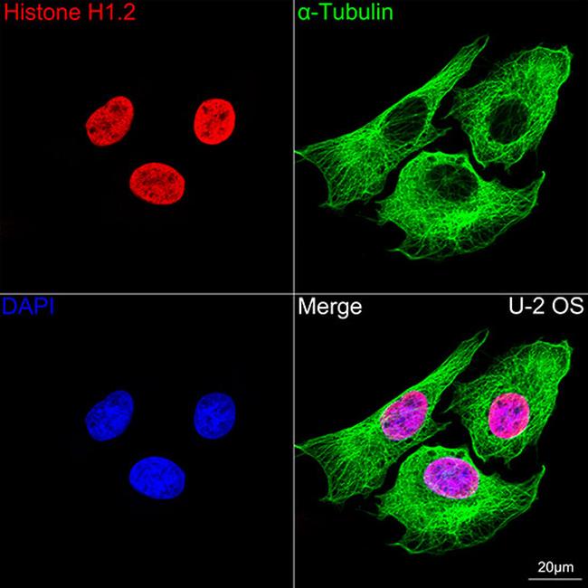 Histone H1.2 Antibody in Immunocytochemistry (ICC/IF)