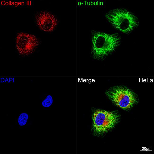 Collagen III Antibody in Immunocytochemistry (ICC/IF)