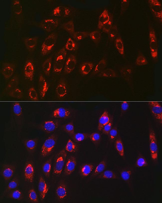 MGST1 Antibody in Immunocytochemistry (ICC/IF)