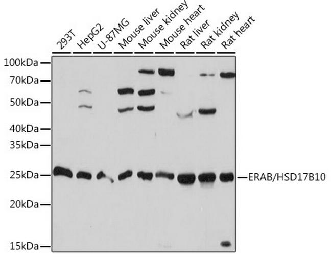 ERAB Antibody in Western Blot (WB)