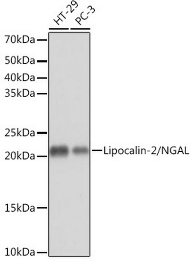 NGAL Antibody in Western Blot (WB)