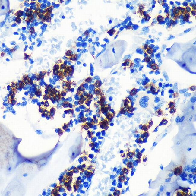 S100A8 Antibody in Immunohistochemistry (Paraffin) (IHC (P))