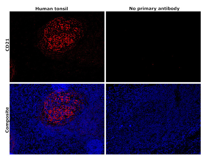 CD21 Antibody in Immunohistochemistry (Paraffin) (IHC (P))