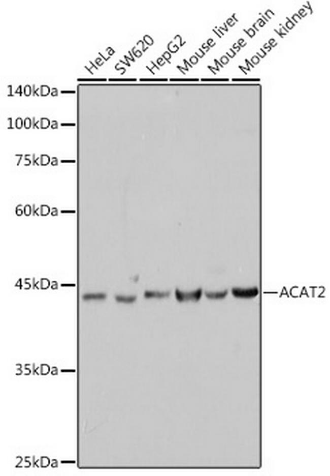 ACAT2 Antibody in Western Blot (WB)