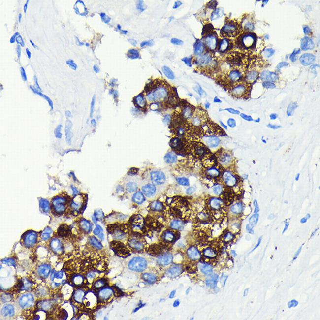 CRP Antibody in Immunohistochemistry (Paraffin) (IHC (P))