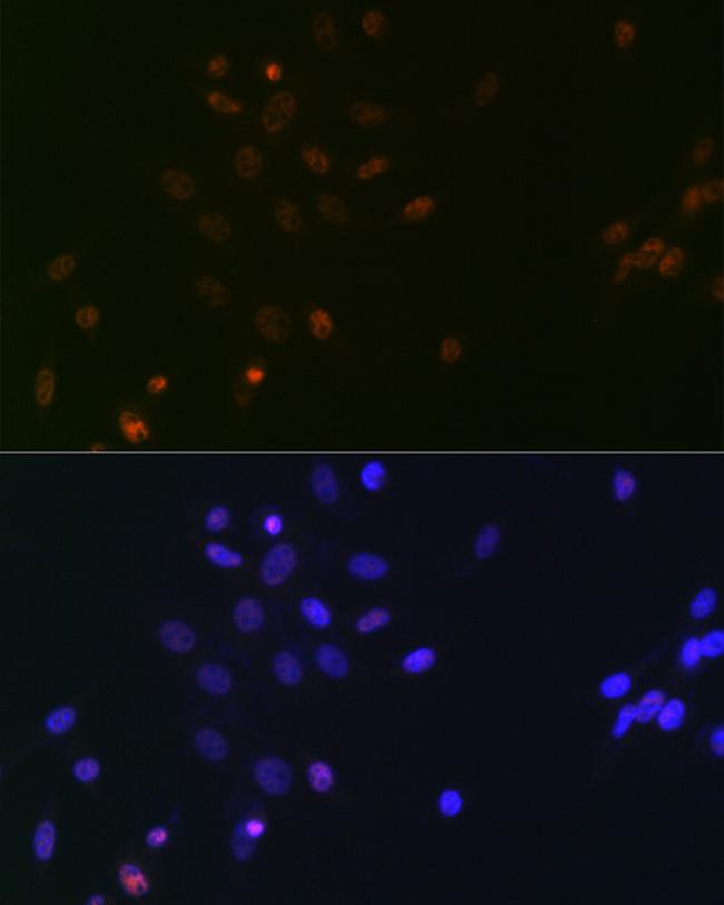 SPT5 Antibody in Immunocytochemistry (ICC/IF)