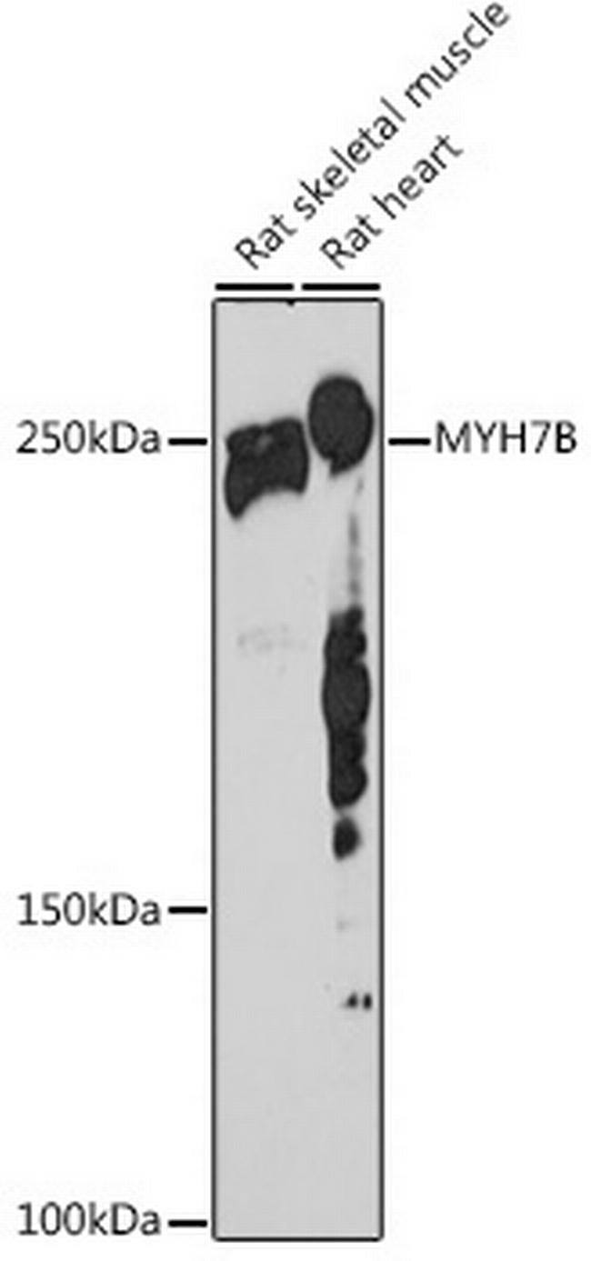 MYH7B Antibody in Western Blot (WB)