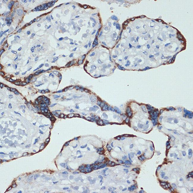 HSD3B1 Antibody in Immunohistochemistry (Paraffin) (IHC (P))