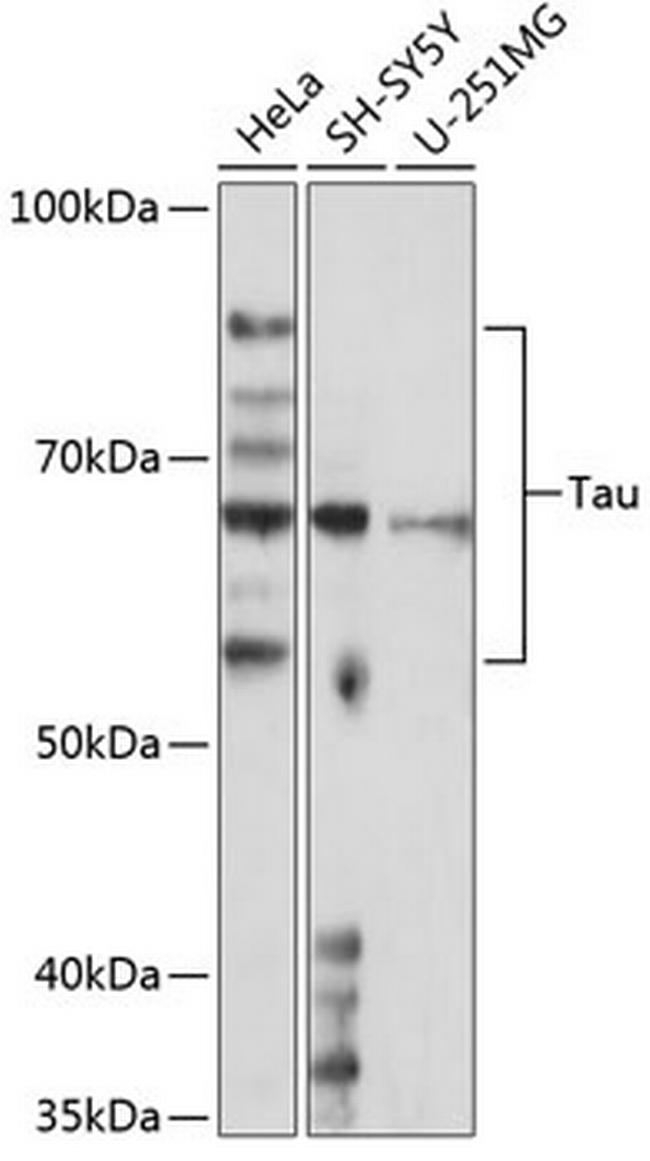 Tau Antibody in Western Blot (WB)