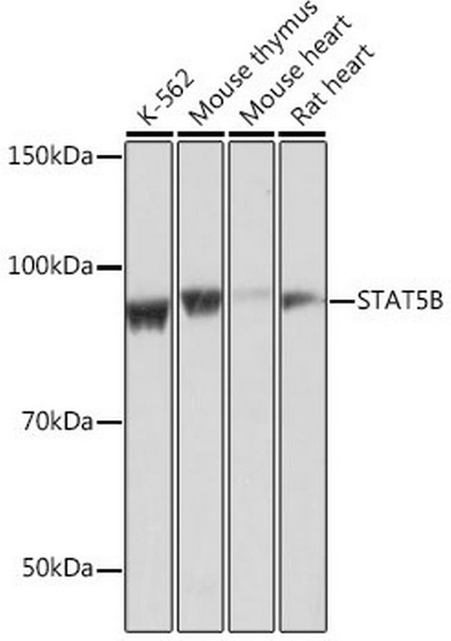 STAT5 beta Antibody in Western Blot (WB)