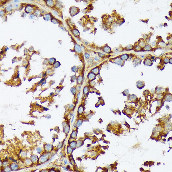 Acetyl-CoA Carboxylase Antibody in Immunohistochemistry (Paraffin) (IHC (P))