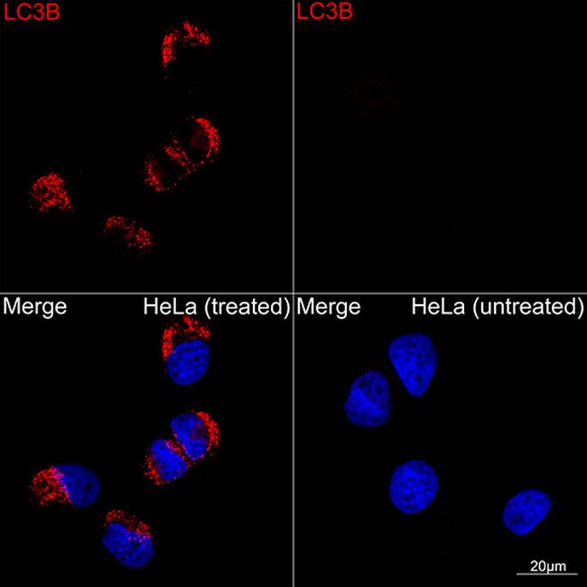 LC3B Antibody in Immunocytochemistry (ICC/IF)