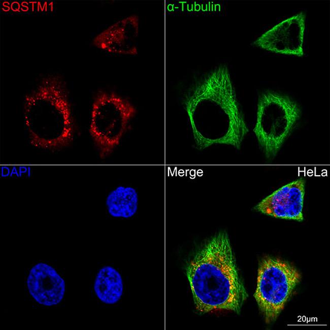 SQSTM1 Antibody in Immunocytochemistry (ICC/IF)