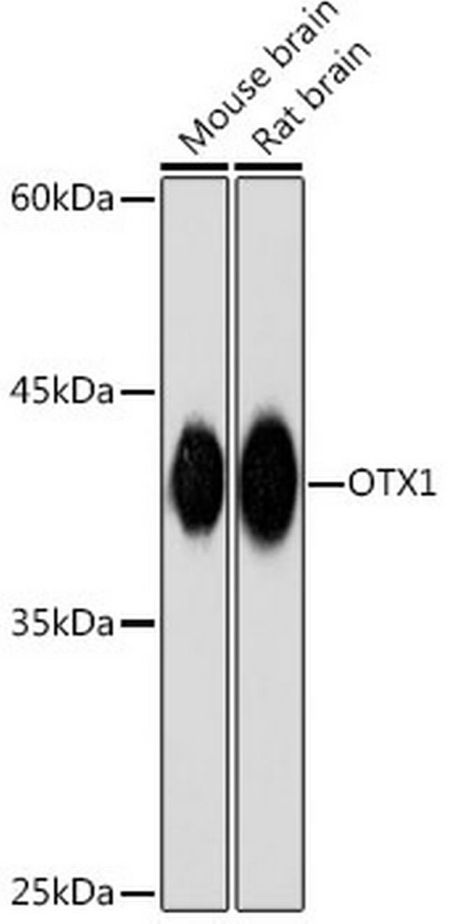 OTX1 Antibody in Western Blot (WB)