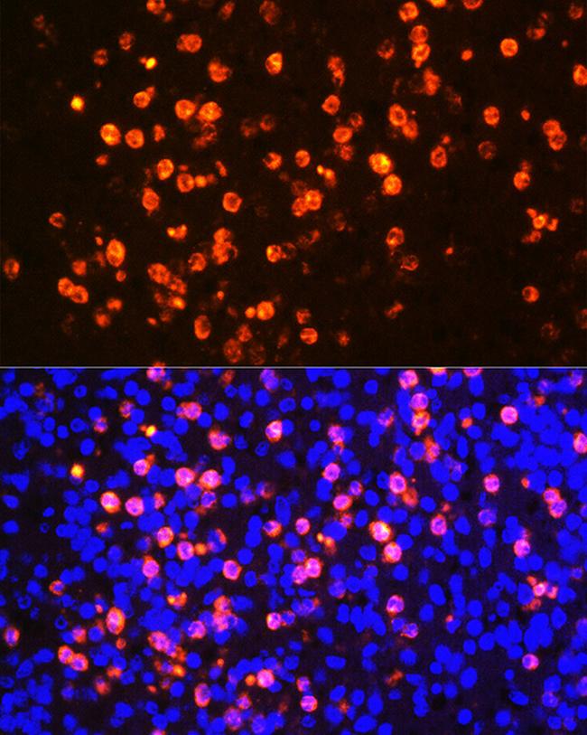 PR3 Antibody in Immunohistochemistry (Paraffin) (IHC (P))