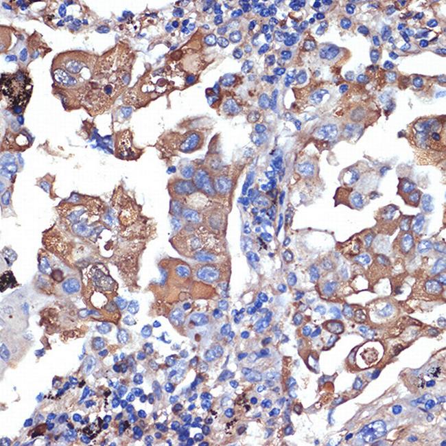 VPS11 Antibody in Immunohistochemistry (Paraffin) (IHC (P))