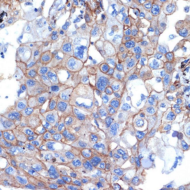 Talin 2 Antibody in Immunohistochemistry (Paraffin) (IHC (P))