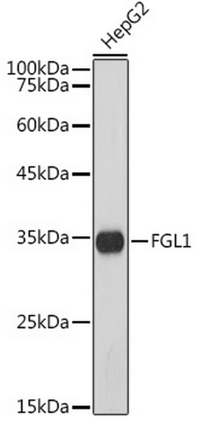 FGL1 Antibody in Western Blot (WB)