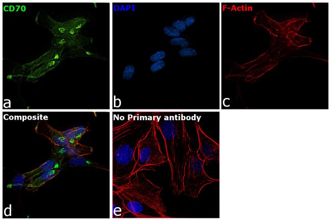 CD70 Antibody in Immunocytochemistry (ICC/IF)