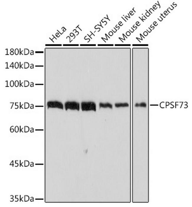 CPSF3 Antibody in Western Blot (WB)