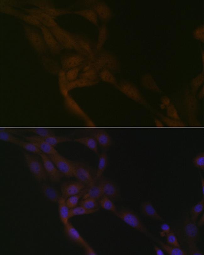 SMURF2 Antibody in Immunocytochemistry (ICC/IF)