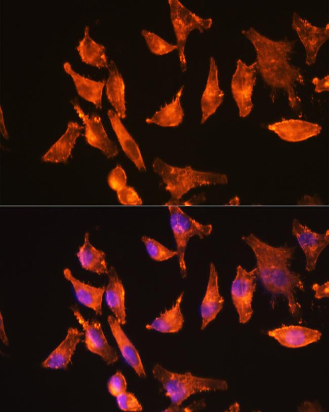 ACTA1 Antibody in Immunocytochemistry (ICC/IF)