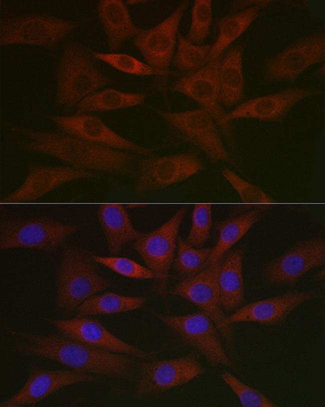 RCL Antibody in Immunocytochemistry (ICC/IF)