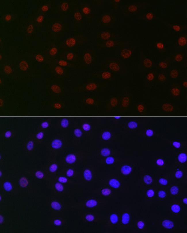 USP39 Antibody in Immunocytochemistry (ICC/IF)