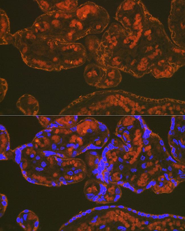 PGF Antibody in Immunohistochemistry (Paraffin) (IHC (P))