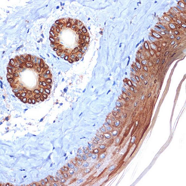 Cytokeratin 2e Antibody in Immunohistochemistry (Paraffin) (IHC (P))