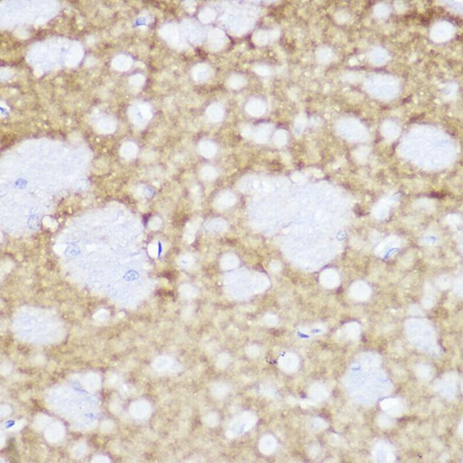 TrkA/TrkB/TrkC Antibody in Immunohistochemistry (Paraffin) (IHC (P))