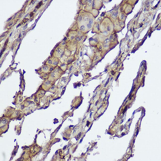 AKT1/AKT2 Antibody in Immunohistochemistry (Paraffin) (IHC (P))