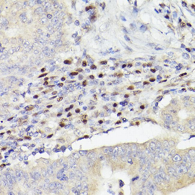 MEF2A/MEF2C Antibody in Immunohistochemistry (Paraffin) (IHC (P))