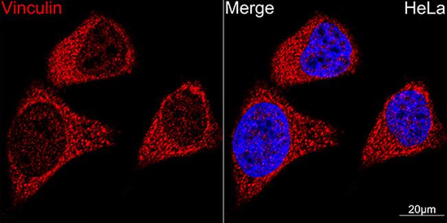 Vinculin Antibody in Immunocytochemistry (ICC/IF)