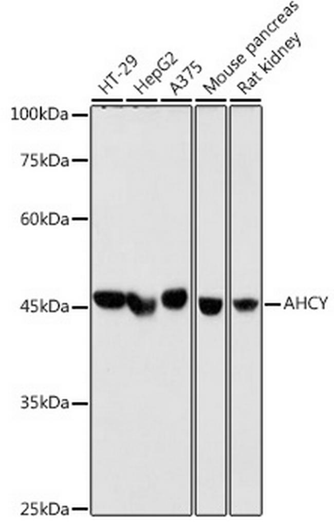 AHCY Antibody in Western Blot (WB)