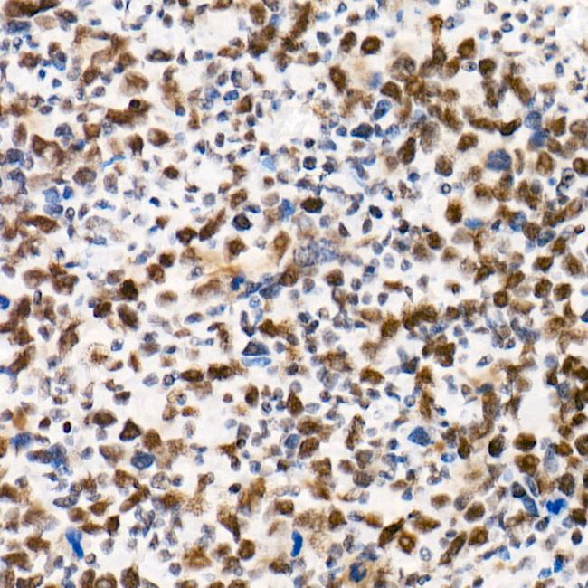 SMARCB1 Antibody in Immunohistochemistry (Paraffin) (IHC (P))